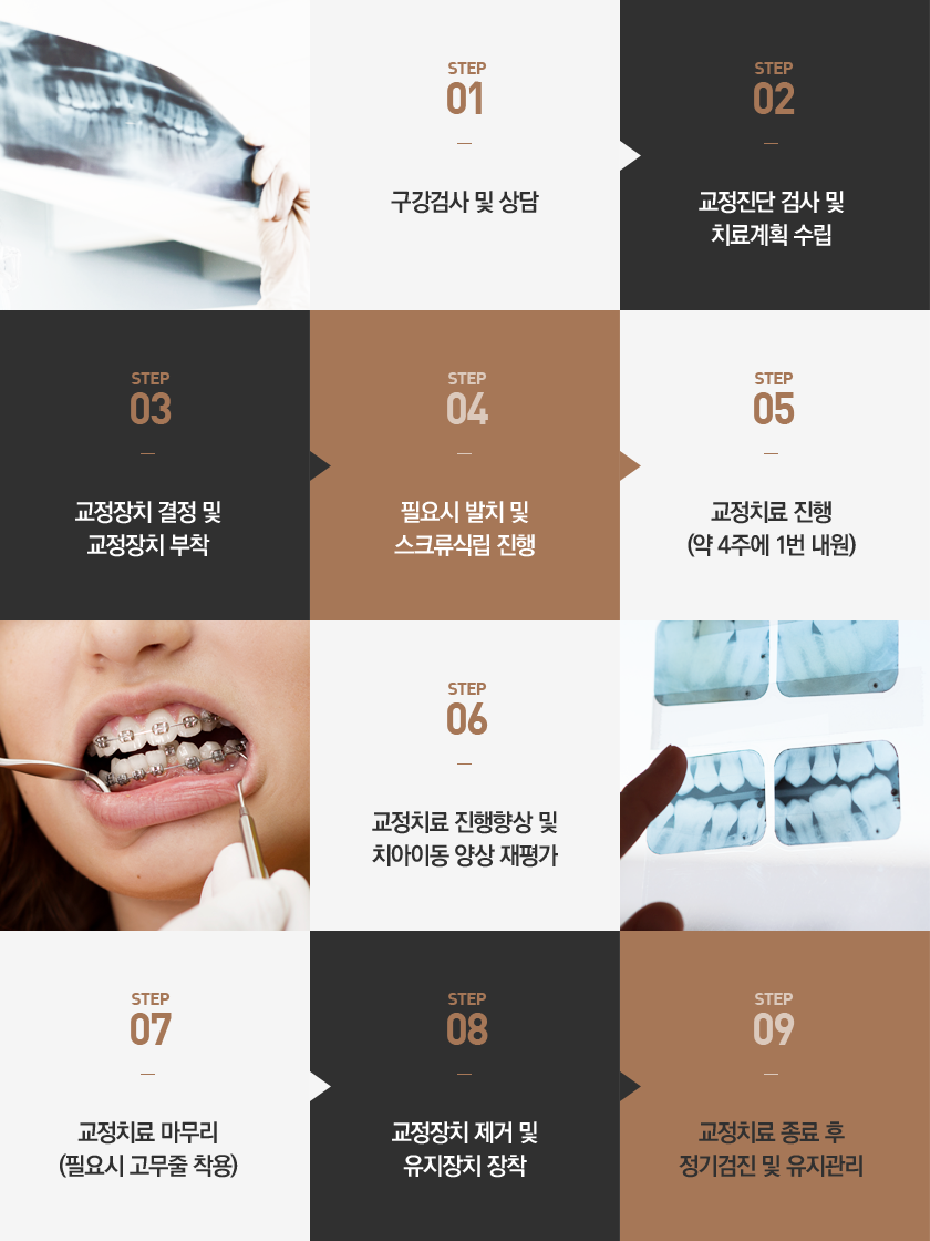 치아교정 과정