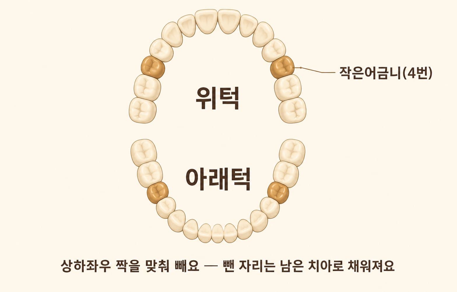 인포그래픽 — 상하좌우 짝을 맞춘 발치 패턴