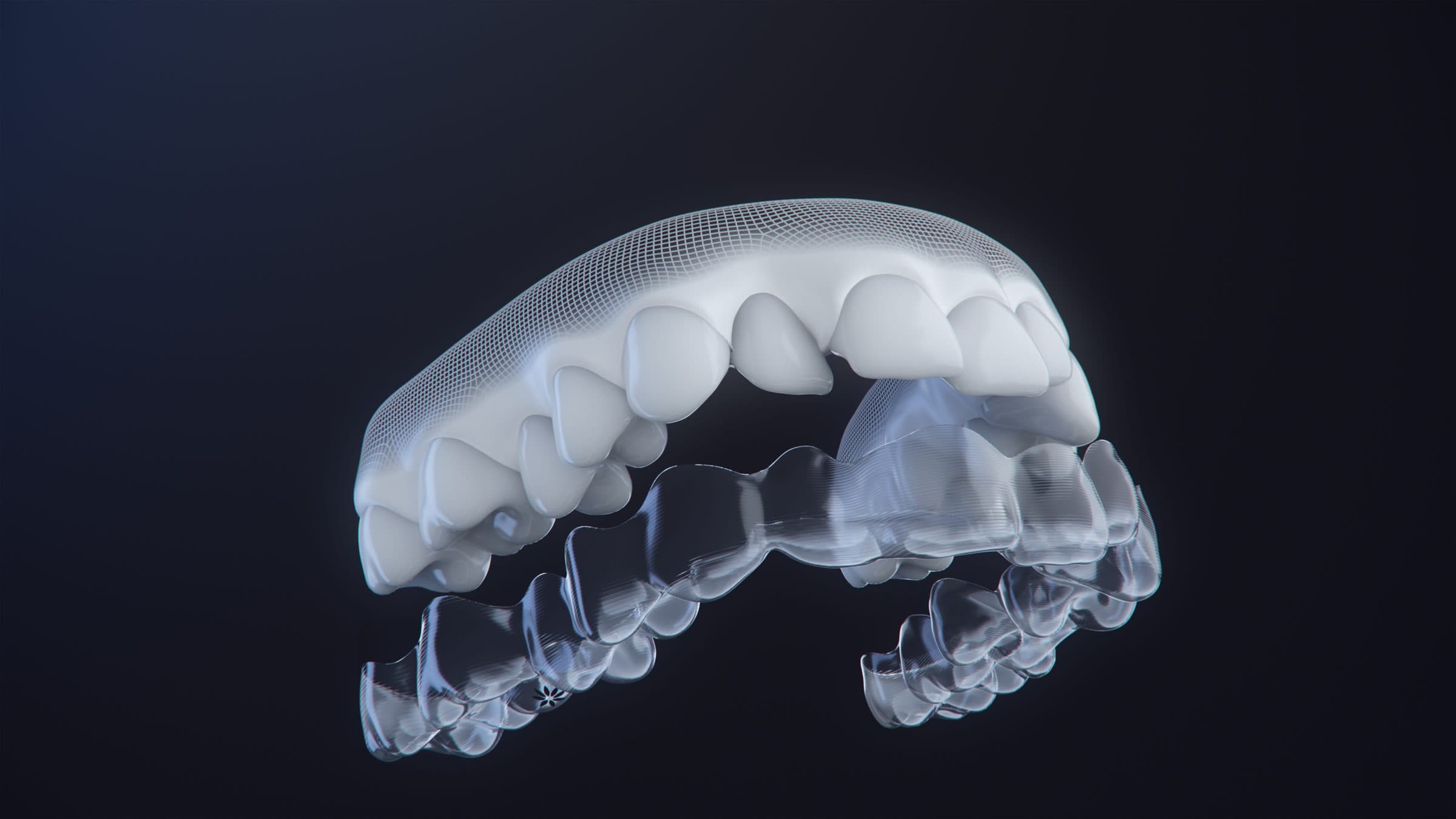 인비절라인 투명 교정장치를 치아 모형에 씌우는 3D 렌더링